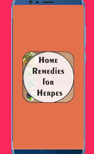 Home Remedies for Herpes 1