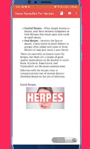 Home Remedies for Herpes 4
