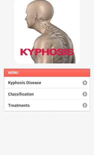 Kyphosis Disease 3