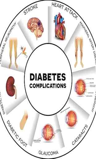 sintomi del diabete 1
