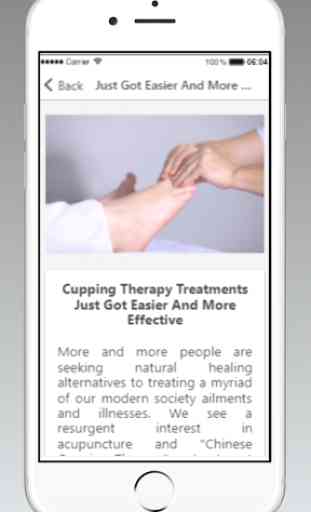 Cupping Therapy Guide 3