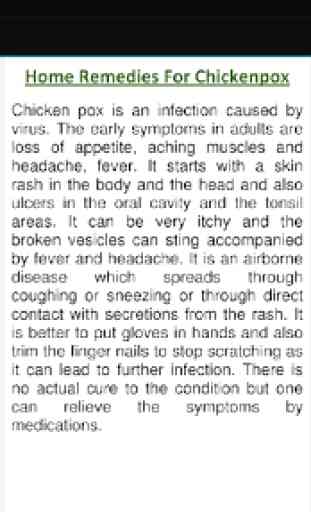 Home Remedy for Chicken Pox 2
