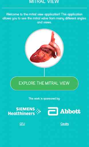 Mitral View 1